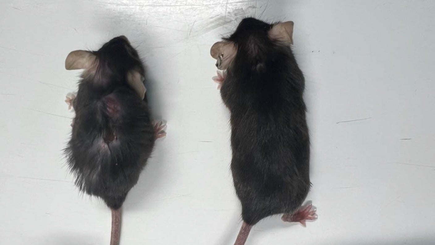 科学者らは抗体薬でマウスの寿命を25%延ばしたと発表