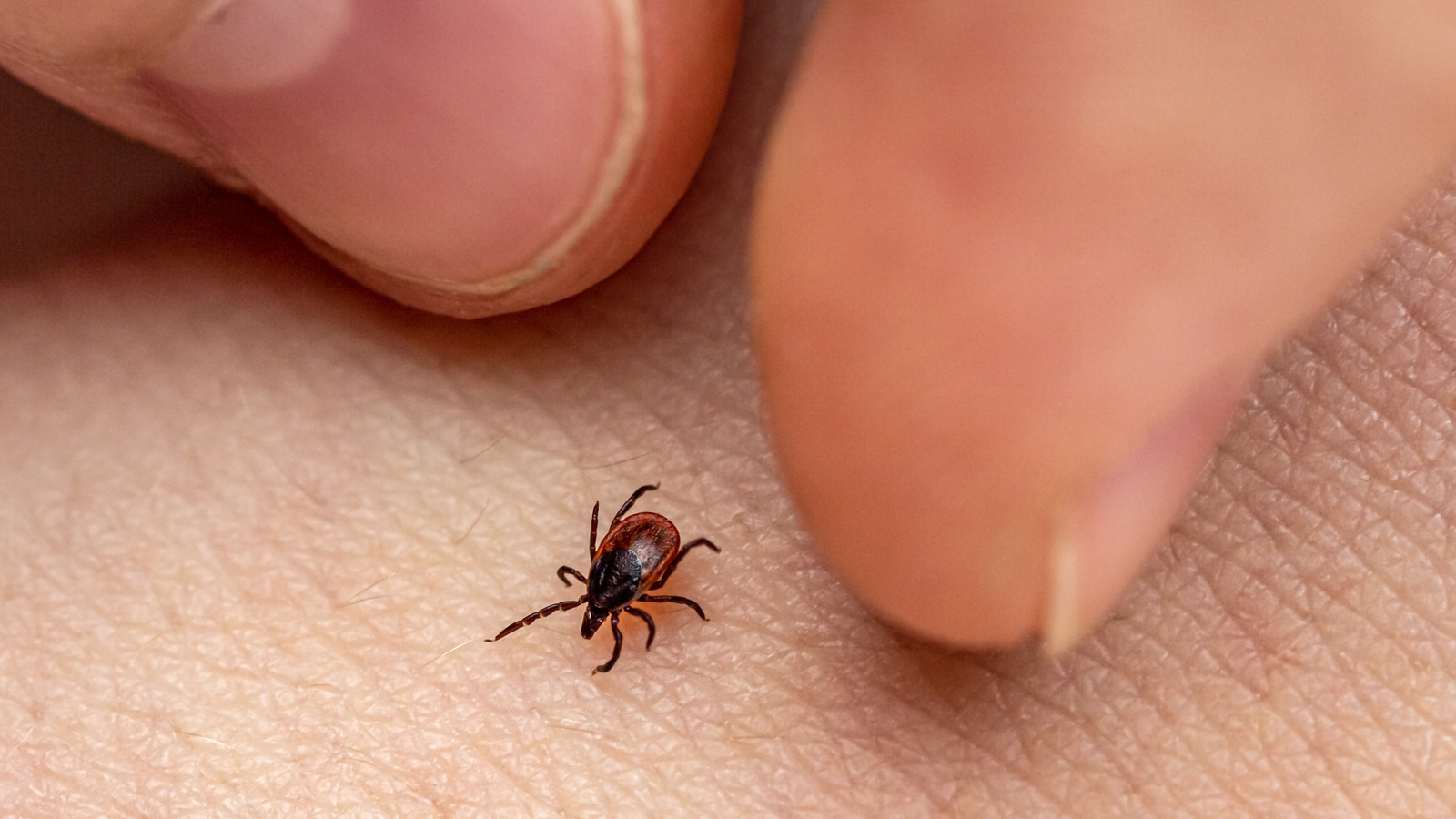 感染の可能性を高める一般的なダニ駆除方法